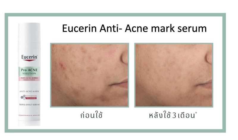 Tinh Chất Eucerin Pro ACNE Solution Protect Post-Acne Marks Form Darkening Dưỡng Sáng, Giảm Thâm 40ml