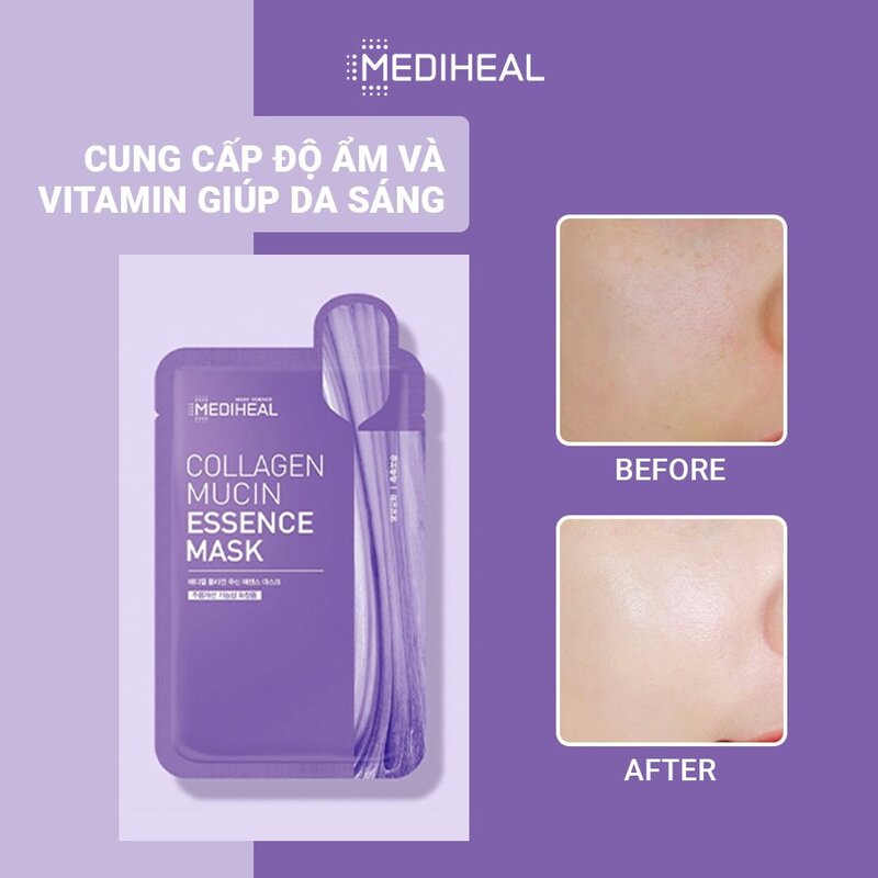 Mặt Nạ Mediheal Collagen Mucin Essence Mask Giảm Nếp Nhăn, Ngăn Ngừa Lão Hoá 20ml