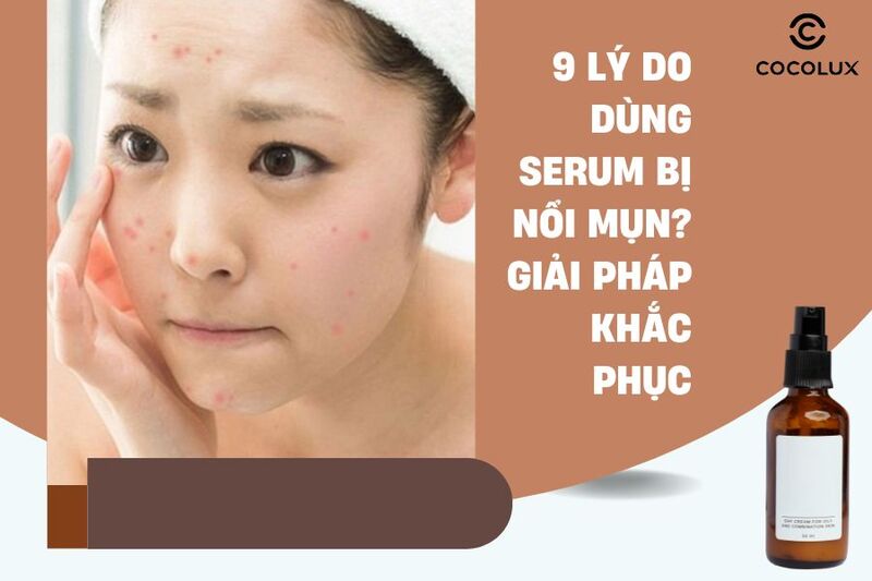 9 lý do dùng serum bị nổi mụn? Giải pháp khắc phục hiệu quả
