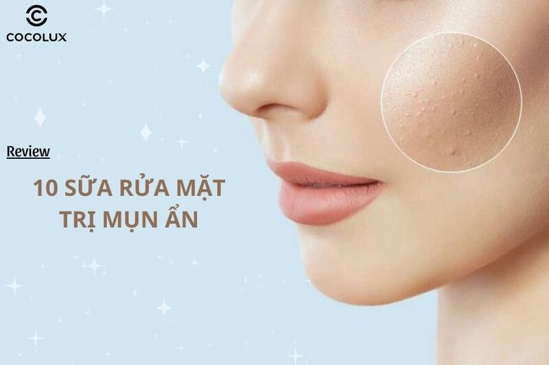 10+ Sữa rửa mặt trị mụn ẩn CỰC CHẤT LƯỢNG, hiệu quả nhất hiện nay