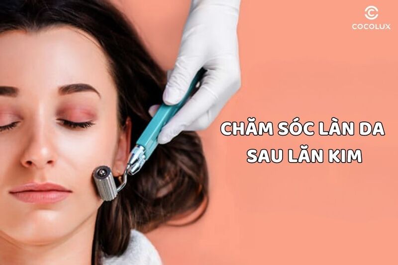 Bật mí cách chăm sóc da mặt sau khi lăn kim nhanh phục hồi