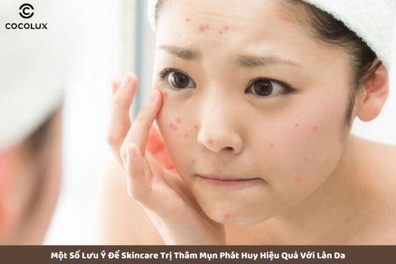 Một số lưu &yacute; để skincare trị th&acirc;m mụn ph&aacute;t huy hiệu quả với l&agrave;n da 