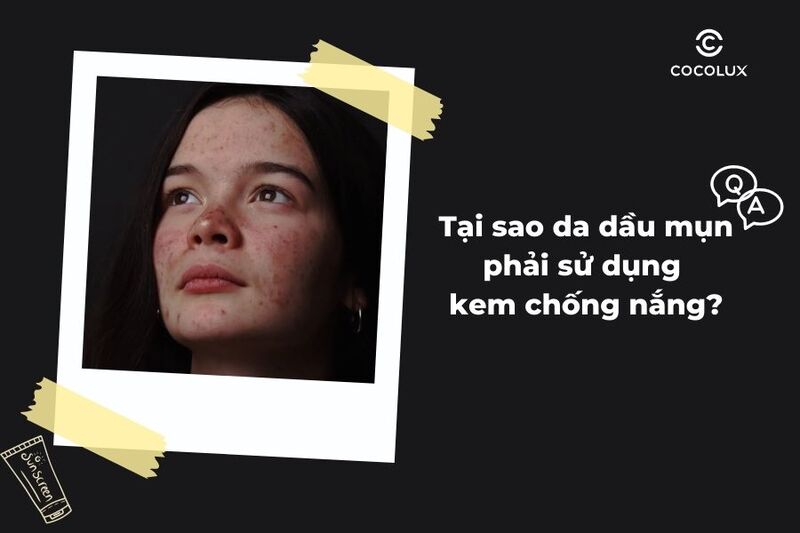Tại sao da dầu mụn phải sử dụng kem chống nắng?