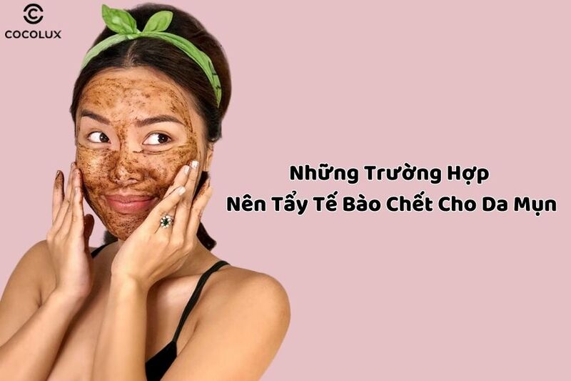 Tẩy tế bào chết cho da mụn