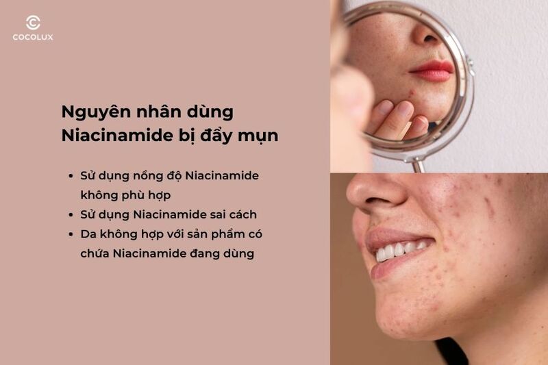 Nguyên nhân dùng Niacinamide bị đẩy mụn
