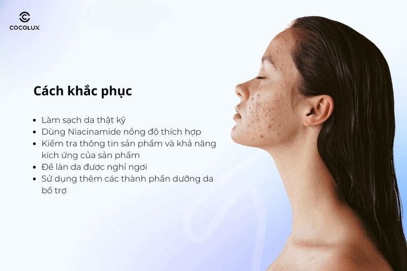 Cách khắc phục dùng Niacinamide bị lên mụn