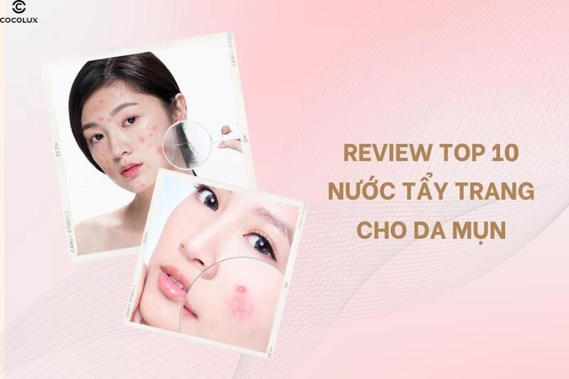 Review top 10 nước tẩy trang dành cho da mụn được ưa chuộng nhất