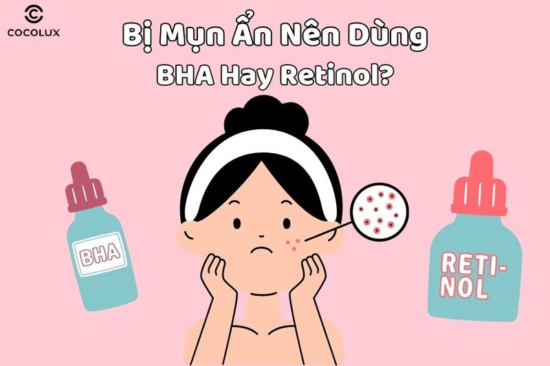 Da bị mụn ẩn nên dùng BHA hay Retinol?