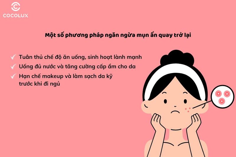 ​​​​​​​Một số phương pháp ngăn ngừa mụn quay trở lại