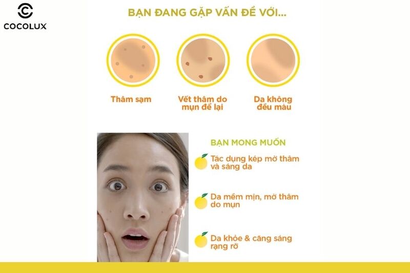 Loại da phù hợp với kem dưỡng ẩm Garnier