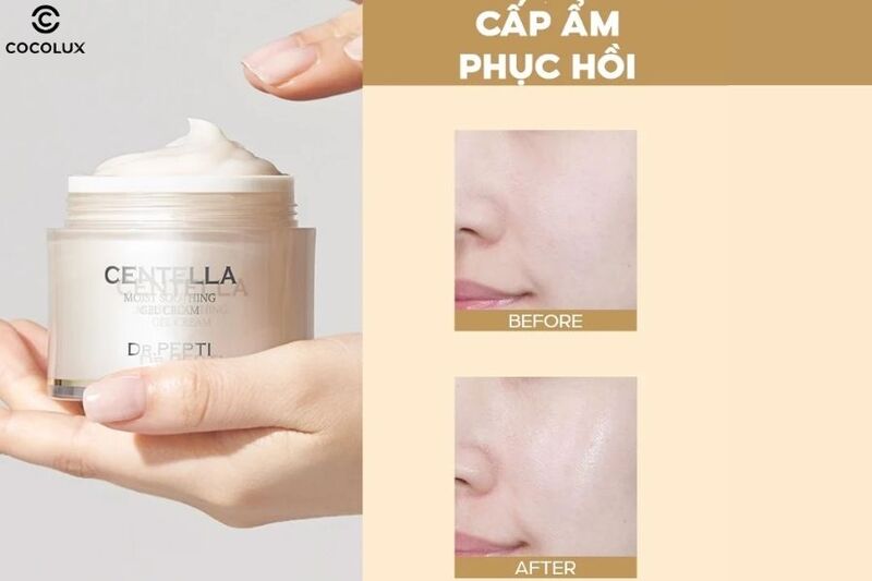 Cảm nhận sau khi d&ugrave;ng kem dưỡng Dr.Pepti Centalla Moist Soothing Gel Cream