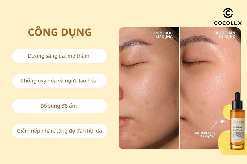 Công dụng của tinh chất Cocoon chiết xuất từ nghệ Hưng Yên