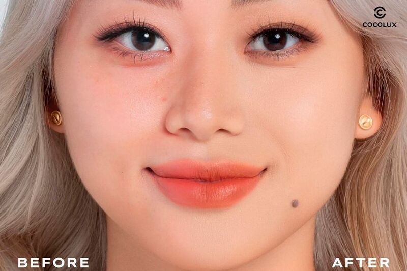 Trước và sau khi sử dụng Che Khuyết Điểm Lemonade Matte Addict Concealer tone 03