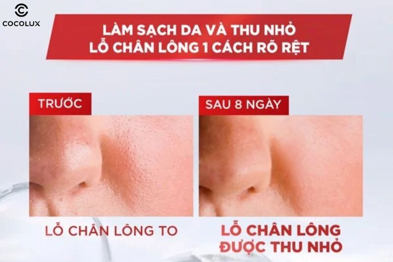 Công dụng chính của nước tẩy trang Loreal Revitalift Crystal đa năng 3in1 kiềm dầu