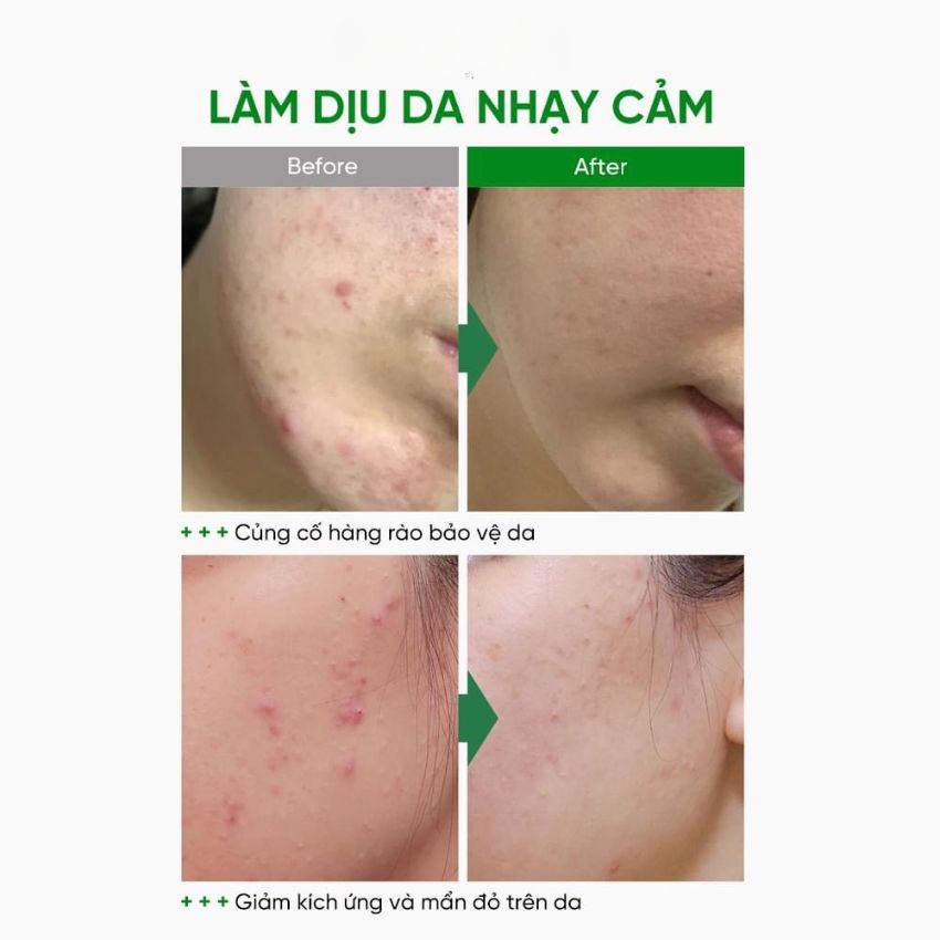 Kem Dưỡng Sungboon Cocklebur Namomi Repair Cream+ Phục Hồi Da 50ml