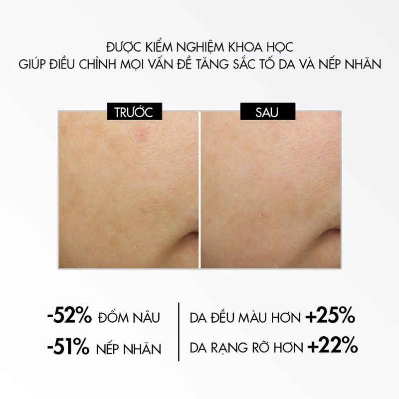 Kem Dưỡng Vichy Mờ Nám Dưỡng Sáng Da Ban Đêm Liftactiv B3 Pure Retinol Cream Night 50ml