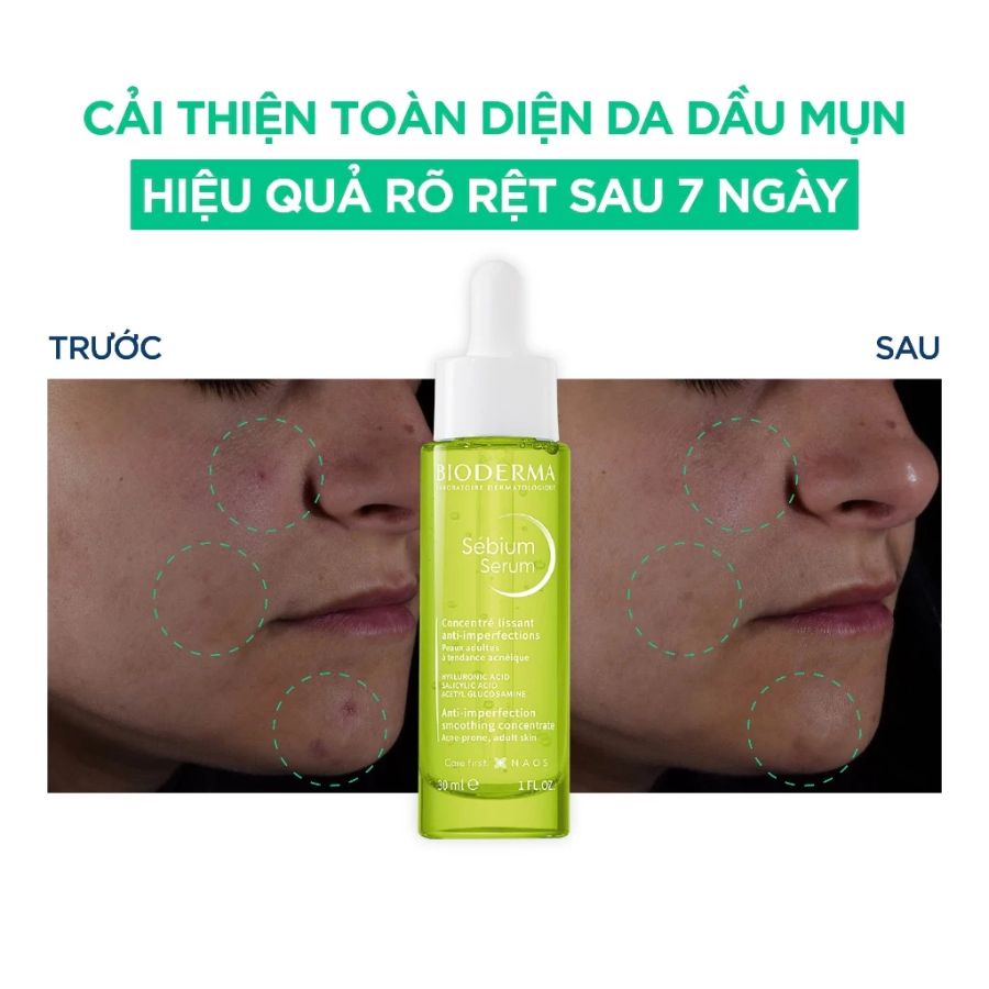 Serum Bioderma Sébium Cho Da Dầu Và Da Mụn 30ml