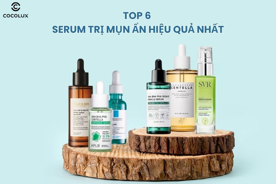 Review top 6 serum trị mụn ẩn hiệu quả nhất hiện nay