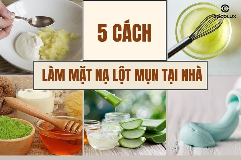 5 cách làm mặt nạ lột mụn tại nhà cực đơn giản, hiệu quả