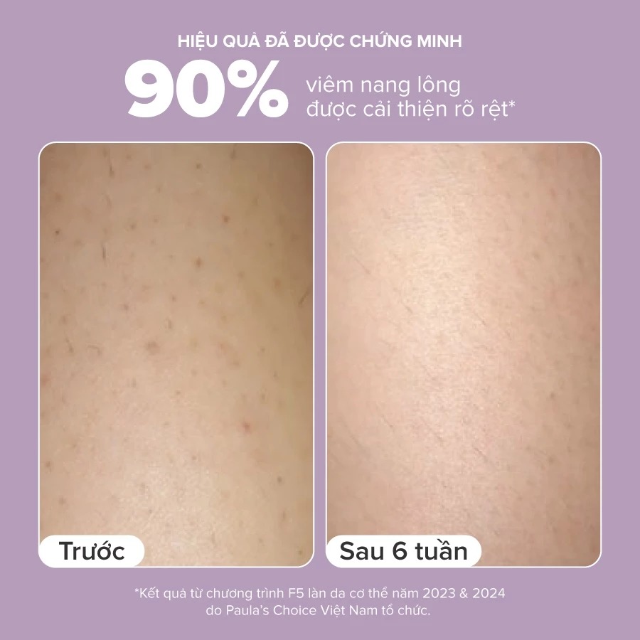 Kem Dưỡng Thể Paula's Choice Hỗ Trợ Giảm Mụn Và Làm Mịn Da 2% BHA Body Smoothing Spot Exfoliant
