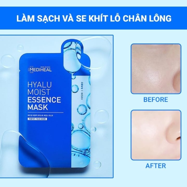 Mặt Nạ Mediheal Hyalu Moist Essence Mask - Xanh Dương (Túi 15 Miếng)