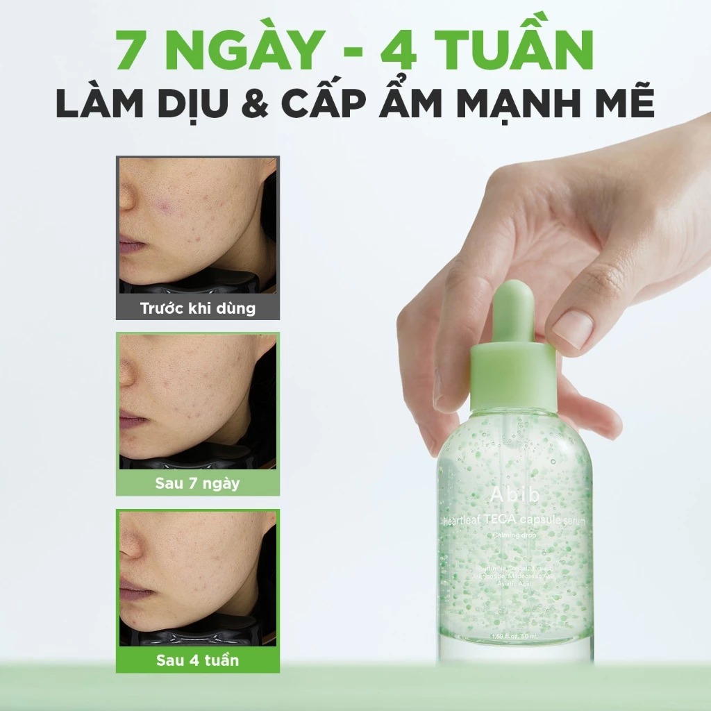 Serum Abib Viên Nang Diếp Cá Làm Dịu Da Heartleaf Teca Capsule Calming Drop 50ml