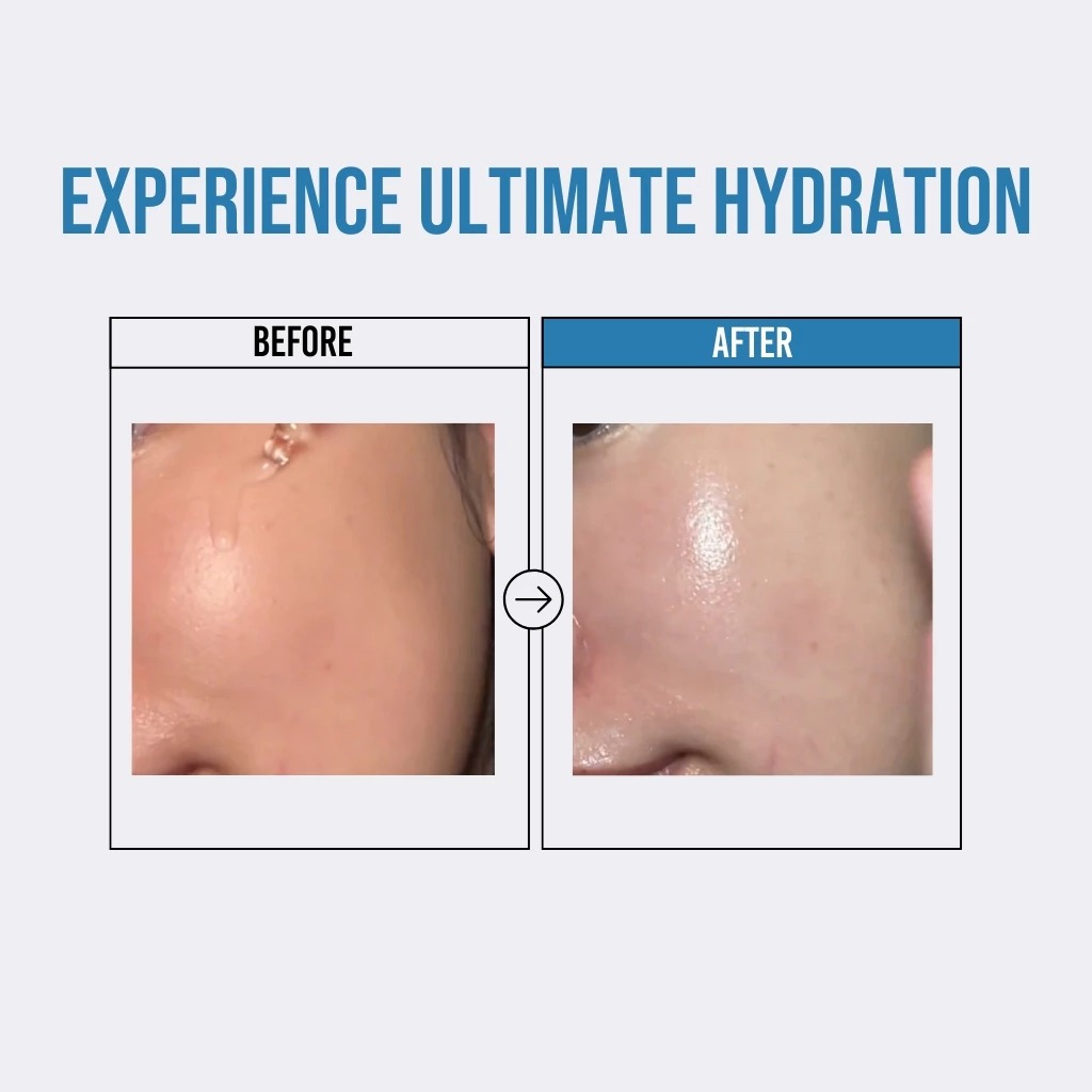 Serum Jumiso Dưỡng Ẩm Da Waterfull Hyaluronic Acid 50ml