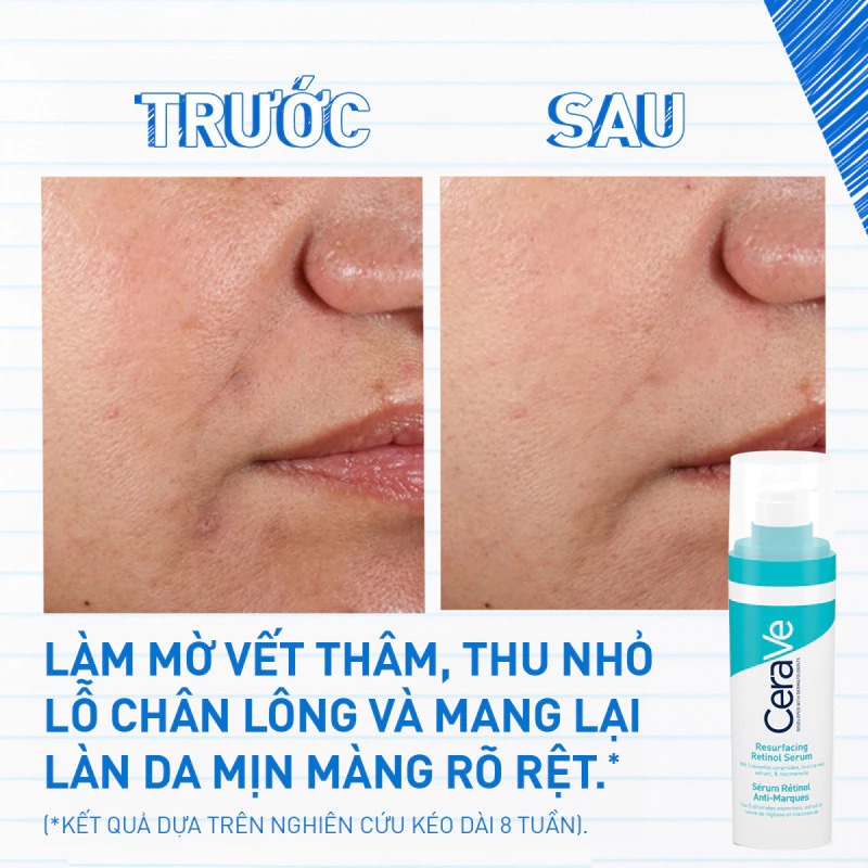 Tinh Chất Cerave Resurfacing Retinol Serum 30ml