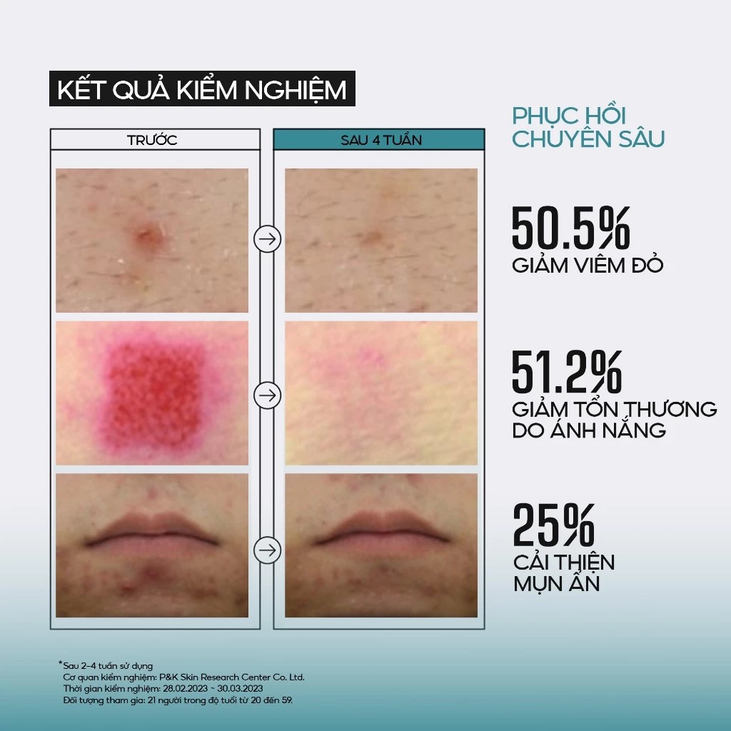 Tinh Chất Jumiso Chiết Xuất Ốc Sên Hỗ Trợ Ngăn Ngừa Lão Hoá Snail Mucin 95+ Peptide Facial Essence 140m