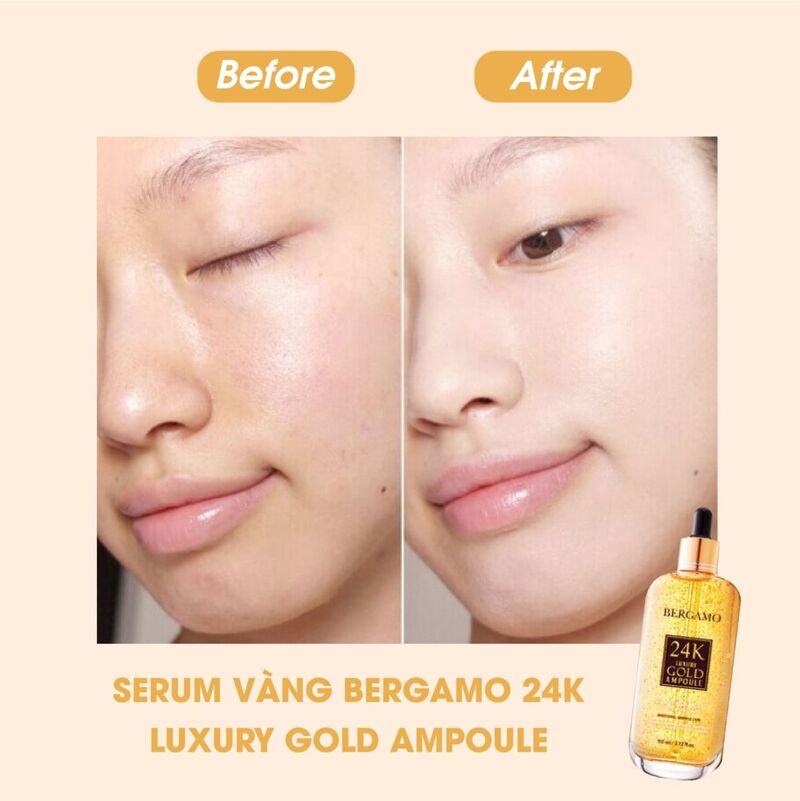 Tinh Chất Bergamo Vàng 24k Luxury Gold Ampoule 110ml