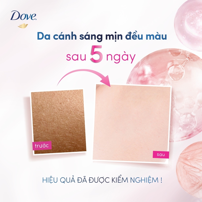 Kem Ngăn Mùi Dove Dưỡng Sáng Da Deodorant Dry Serum 3% Niacinamide +10x Vitamin C&E 40ml