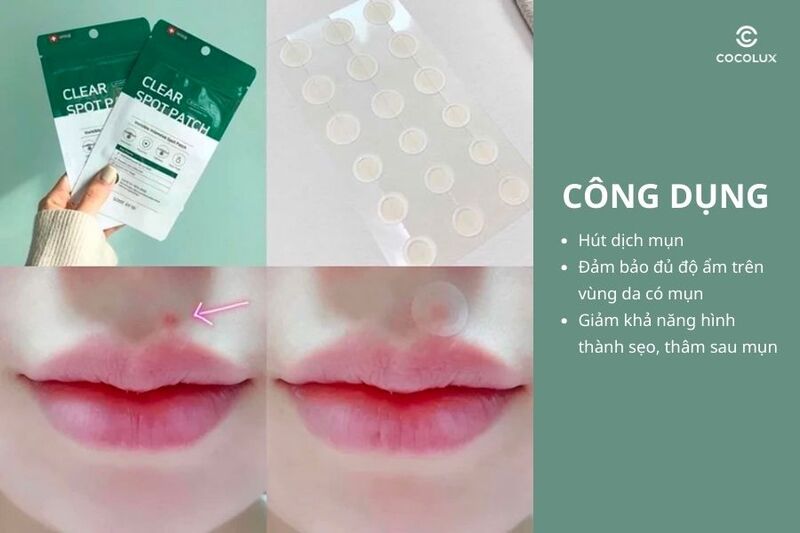 Công dụng của miếng dán mụn Some By Mi