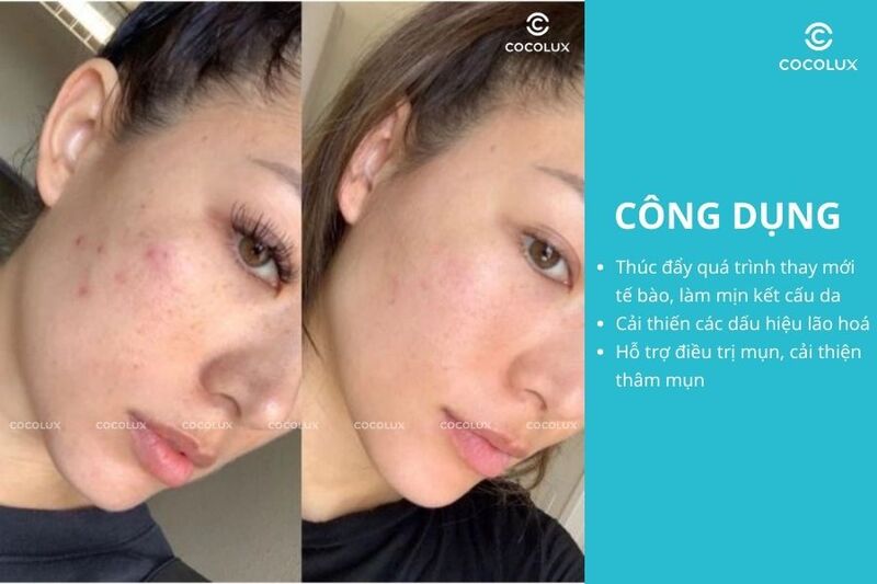 C&ocirc;ng dụng của kem&nbsp;dưỡng Obagi 360 Retinol 0.5 Cream