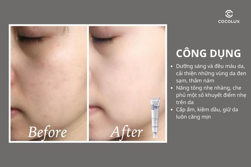 Công dụng của kem dưỡng Sur.Medic+ Super Glutathione 100 Bright Tone Up Cream