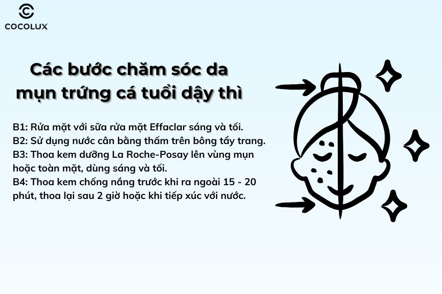 Các bước chăm sóc da mụn trứng cá tuổi dậy thì