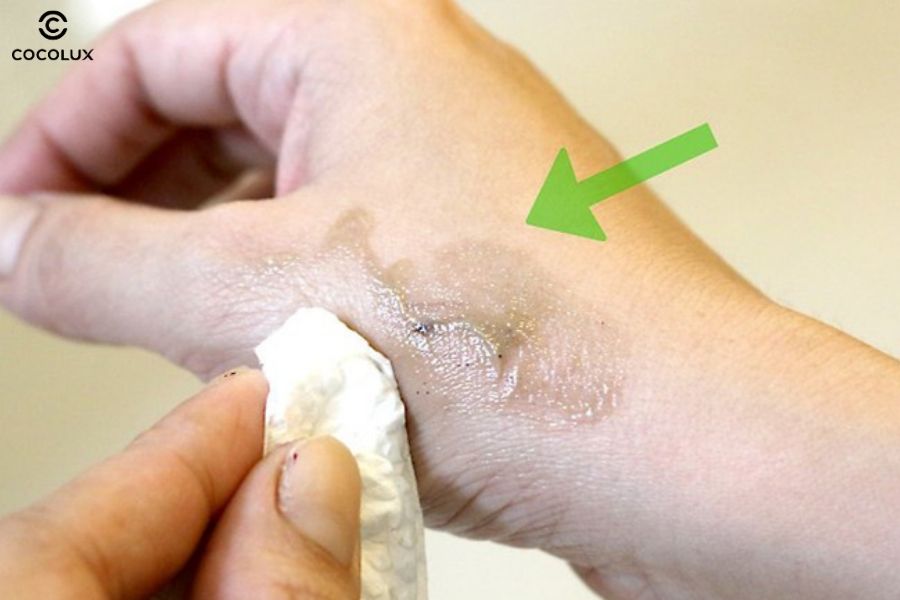 Thuốc nhuộm tóc có thể dính lên da