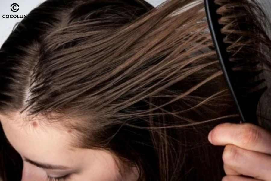 Di truyền v&agrave; nội tiết tố ảnh hưởng đến da đầu dầu với gen v&agrave; hormone c&oacute; thể l&agrave;m tuyến b&atilde; nhờn hoạt động mạnh, khiến t&oacute;c nhanh bết