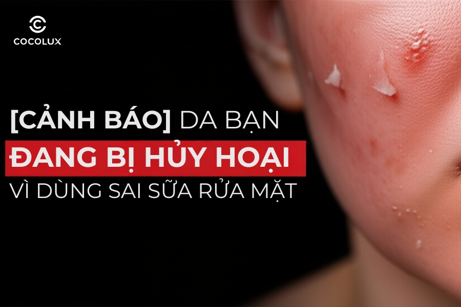 [Cảnh Báo] Da Bạn Đang Bị Hủy Hoại Vì Dùng Sai Sữa Rửa Mặt