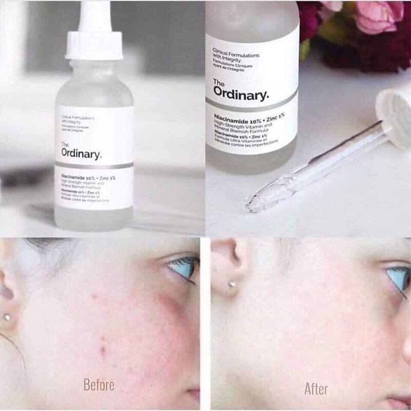 Serum The Ordinary Niaciamide 10% +Zinc1% 60ml