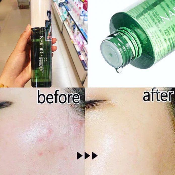 Nước Hoa Hồng Naruko Chiết Xuất Tràm Trà Cho Da Mụn 150ml