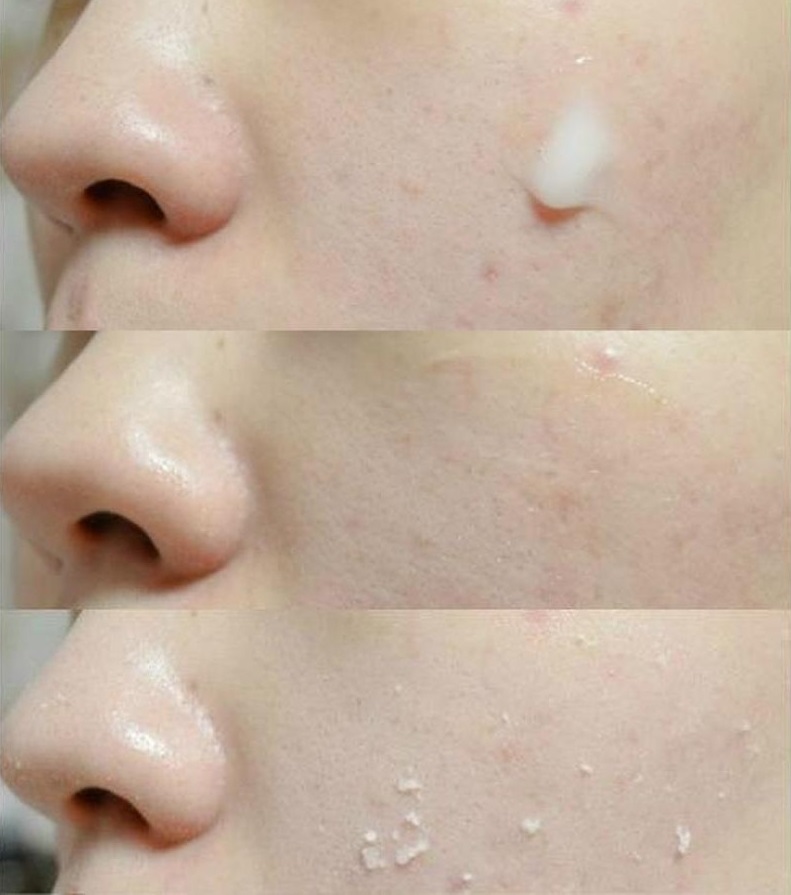Tẩy Da Chết Bioderma Sebium Gel Gommant 100ml