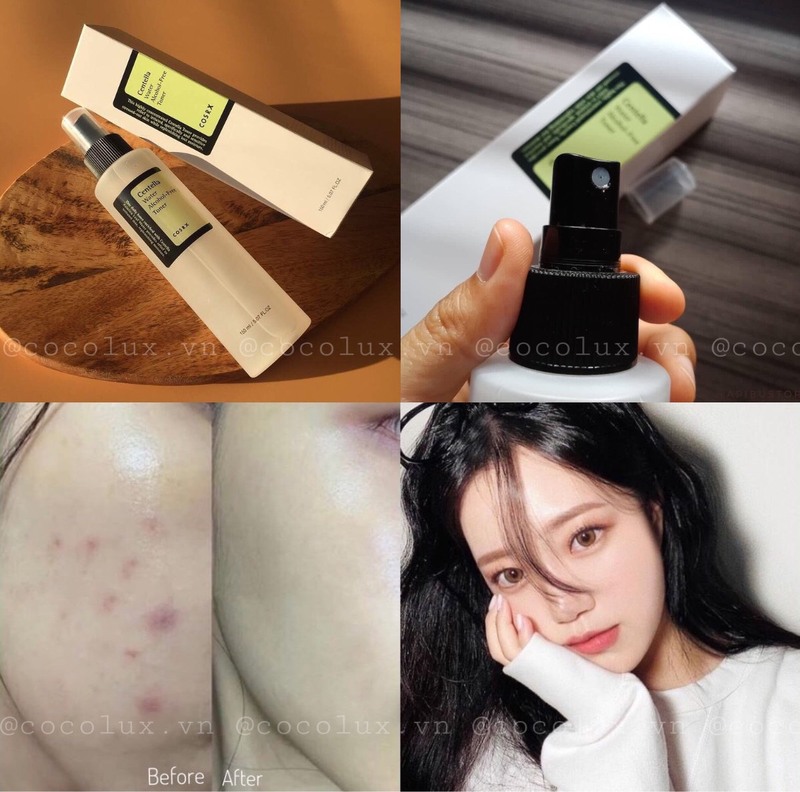 Nước Hoa Hồng Cosrx Centella Water Alcohol Free Toner Giảm Mụn 150ml