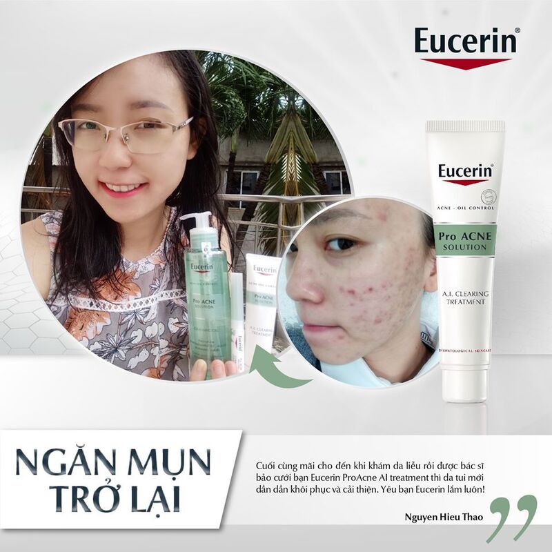 Tinh Chất Eucerin Pro ACNE Solution A.I Clearing Treatment Giảm Mụn Viêm & Mờ Vết Thâm 40ml