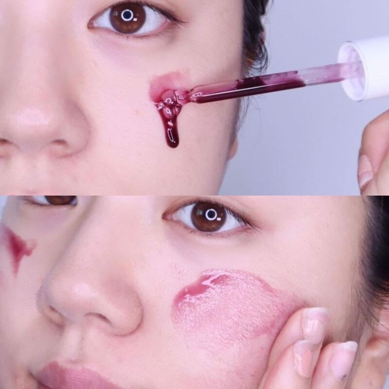 Serum So'Natural Red Peel Tingle Làm Giảm Mụn, Tái Tạo Làn Da 35ml