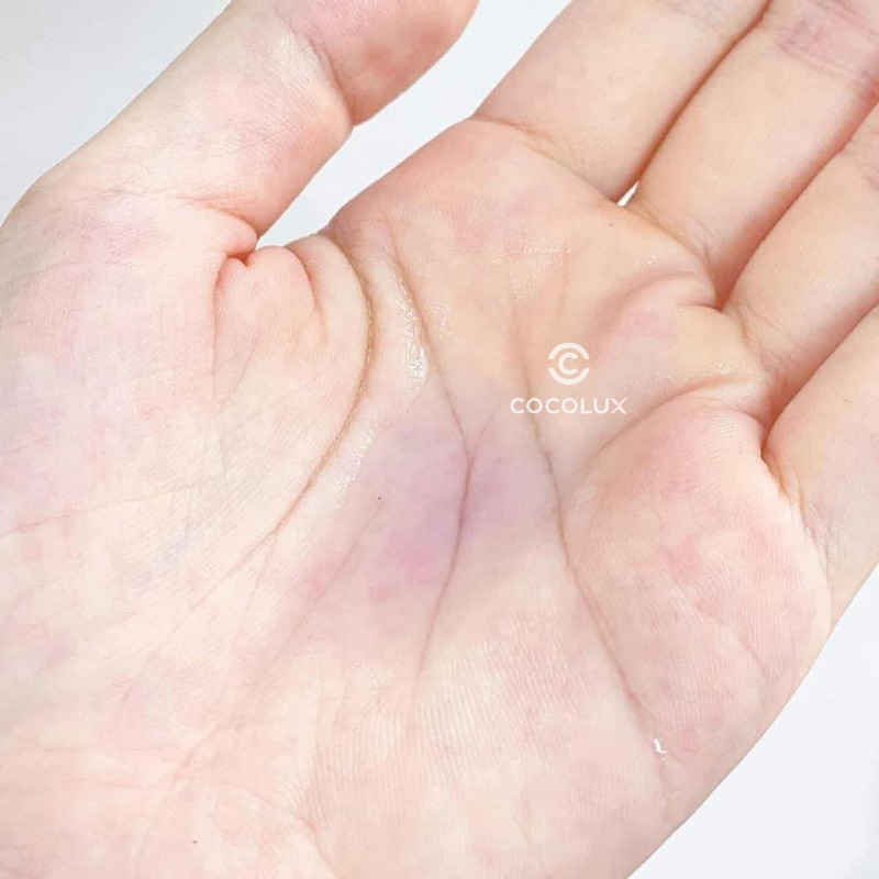 Nước Hoa Hồng OBAGI Clenziderm MD Pore Therapy Giảm Mụn 148ml