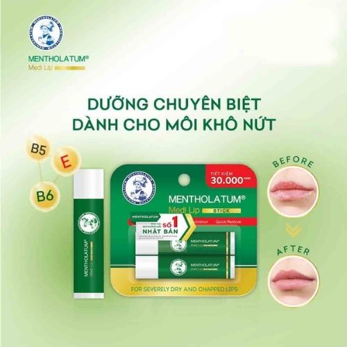 Bộ Sản Phẩm Son Dưỡng Rohto Chuyên Biêt Cho Môi Khô, Nứt Nẻ 4.3gx2