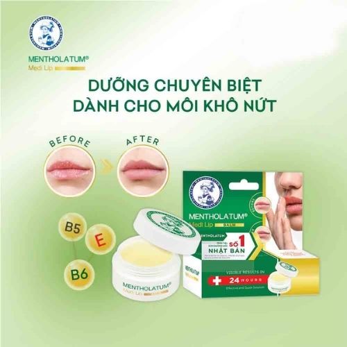 Sáp Dưỡng Rohto Chuyên Biệt Cho Môi Khô, Nứt Nẻ 7g