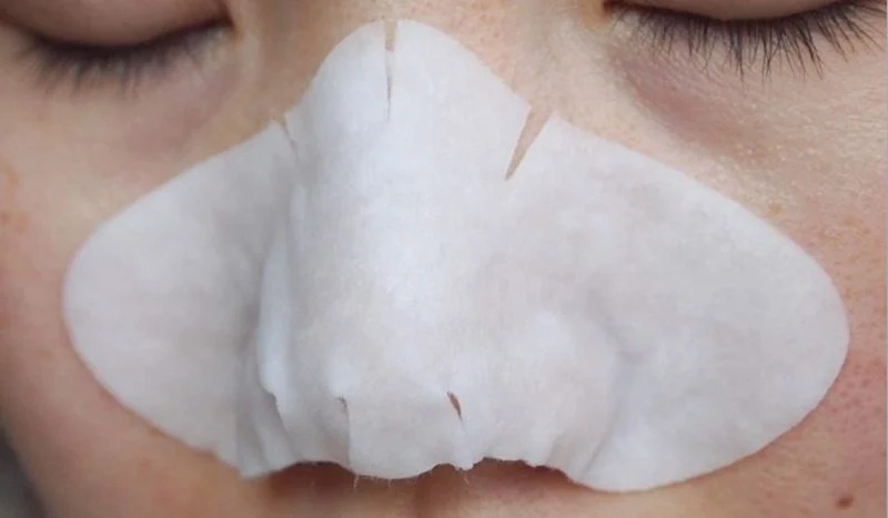 Miếng Đẩy Mụn Ciracle Goodbye Blackhead (1 Hộp)