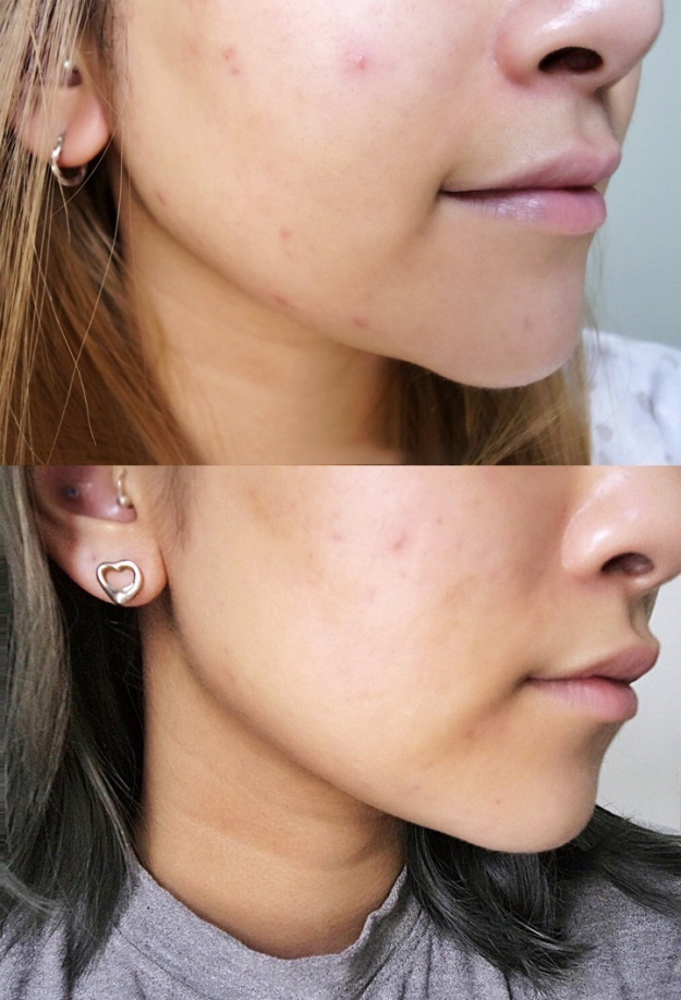 Serum Kiehl's Clearly Corrective Dark Spot Solution 15ml
