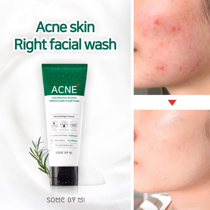 Sữa Rửa Mặt Some By Mi Acne Cho Da Mụn 100ml